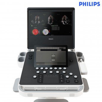 Портативный аппарат УЗИ Philips 5500CV PureWave до 3 часов автономной работы PHILIPS HEALTHCARE