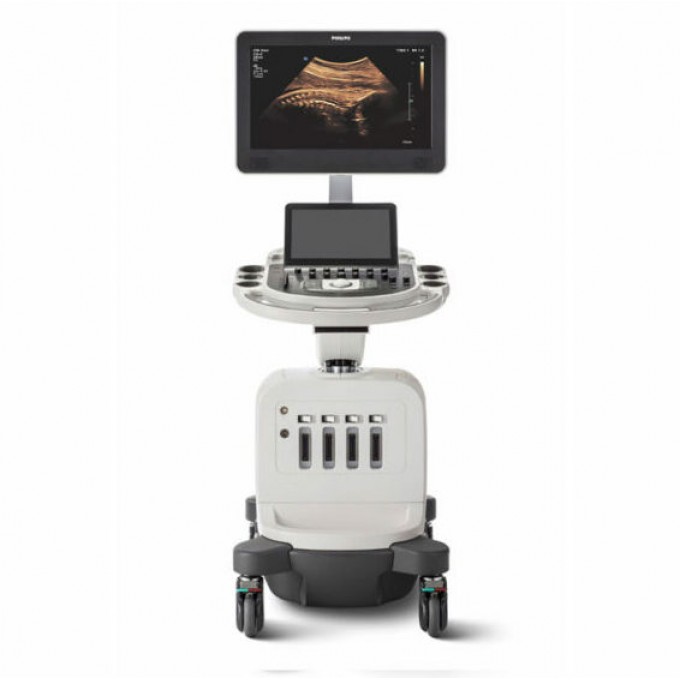 PHILIPS AFFINITI 30 — УЛЬТРАЗВУКОВАЯ СИСТЕМА, 4 порта для датчиков, 21.5-дюймовый дисплей AFFINITI-30