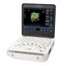 PHILIPS — УЛЬТРАЗВУКОВАЯ СИСТЕМА, ПОРТАТИВНАЯ, 15 ДЮЙМОВЫЙ ЭКРАН CX50